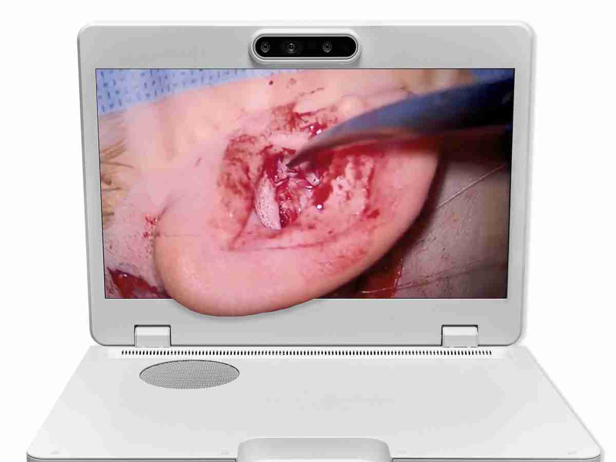 达擎之＂Heads-up 3D显微手术显示系统＂，，，整合4K裸眼3D显示及眼球追踪系统，，，具备快速追踪人眼移动位置功能，，，减轻医师长时间维持固定姿势的负担，，，让医师能有更宽广清晰的3D立体视野及更舒适的姿势来执行手术。。